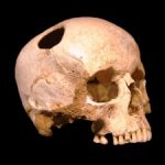 Why the Neolithics Did So Much Trepanning